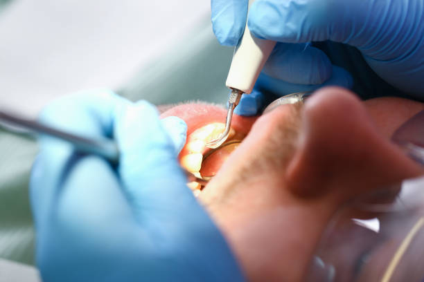 Best Cosmetic Emergency Dentistry in Dunn, NC