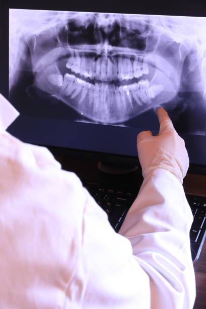 Best Emergency Root Canal Treatment in Dunn, NC